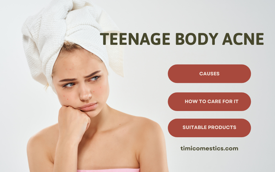 BODY ACNE IN ADOLESCENCE: CAUSES AND EFFECTIVE TREATMENT 🌿 BODY ACNE IN ADOLESCENCE: CAUSES AND EFFECTIVE TREATMENT 🌿