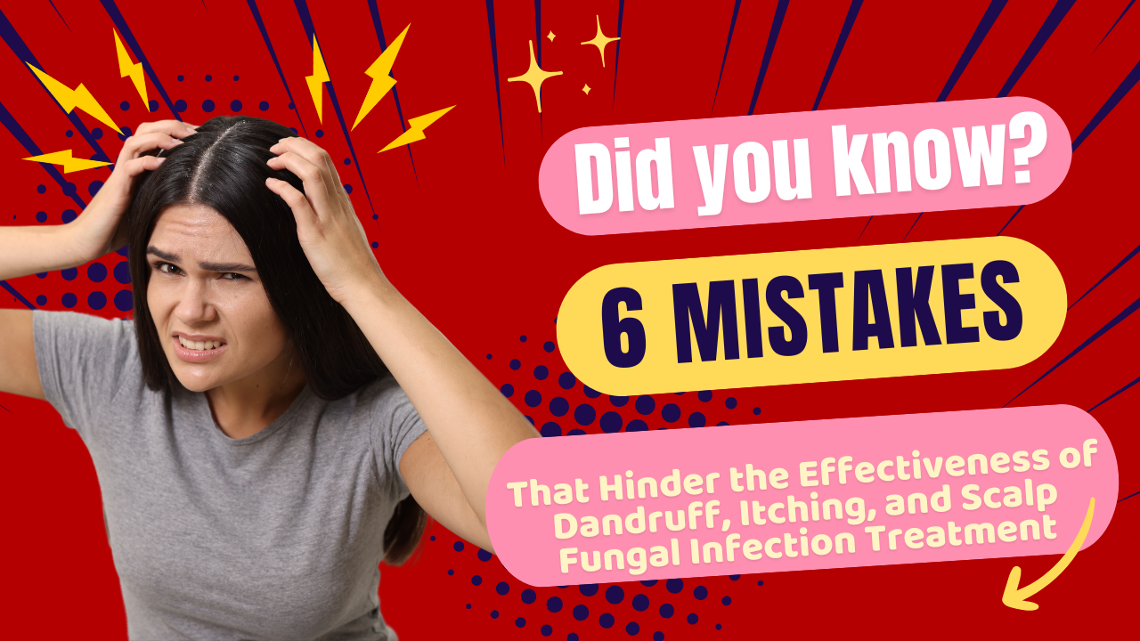 6 MISTAKES TO AVOID WHEN TREATING DANDRUFF, SCALP FUNGAL INFECTIONS, AND SEBORRHEIC DERMATITIS 6 MISTAKES TO AVOID WHEN TREATING DANDRUFF, SCALP FUNGAL INFECTIONS, AND SEBORRHEIC DERMATITIS