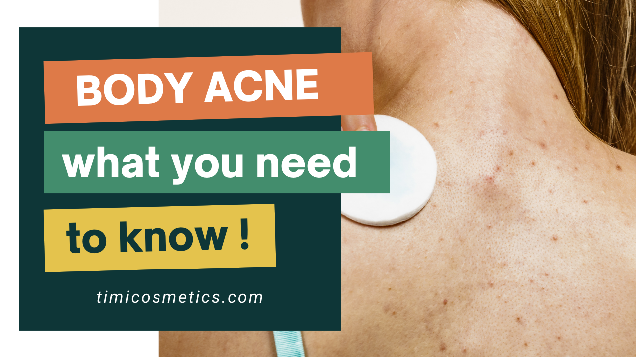 BODY ACNE – THINGS YOU NEED TO KNOW! 💡✨ BODY ACNE – THINGS YOU NEED TO KNOW! 💡✨