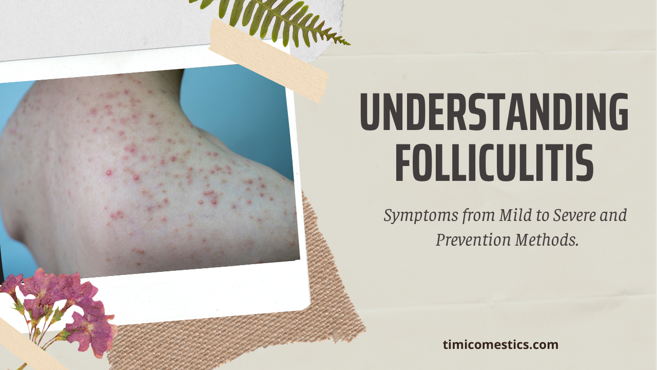 THE SECRET TO BANISHING FOLLICULITIS WITH YEOSA PRODUCTS THE SECRET TO BANISHING FOLLICULITIS WITH YEOSA PRODUCTS