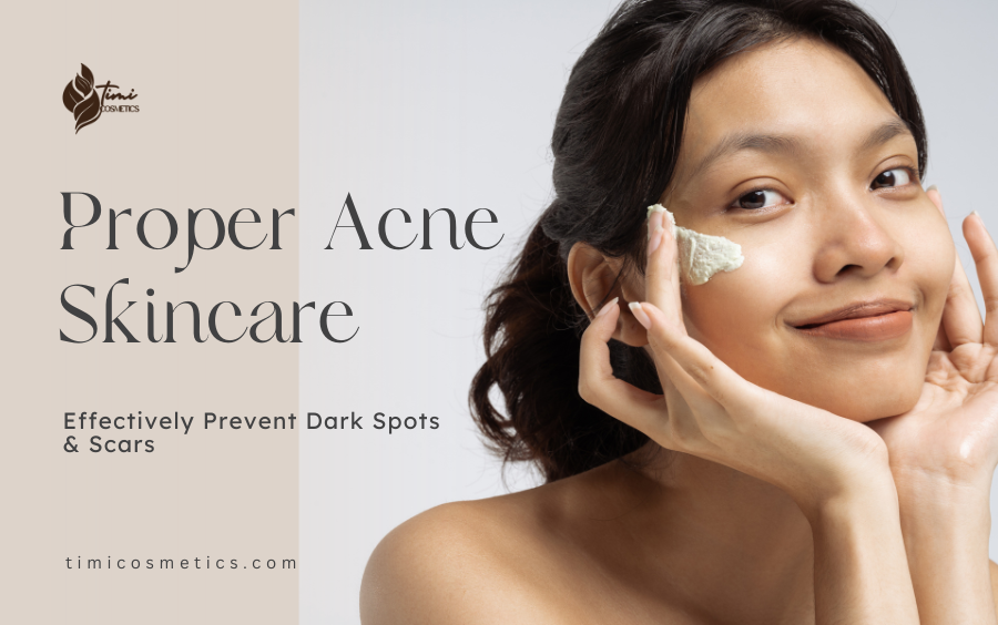 How to Properly Care for Acne-Prone Skin – Effectively Prevent Dark Spots and Scars How to Properly Care for Acne-Prone Skin – Effectively Prevent Dark Spots and Scars