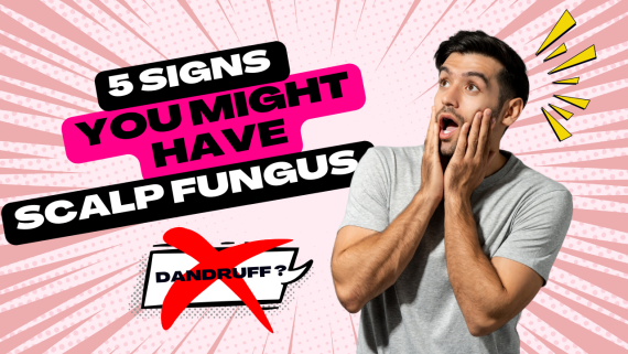 🧠 5 Signs You Might Have SCALP FUNGUS – Don’t Confuse It With DANDRUFF!