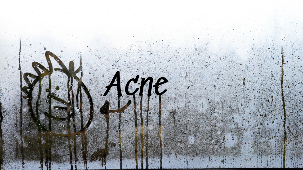 Humid Weather & High Moisture – Hidden Causes of Back & Body Acne! Humid Weather & High Moisture – Hidden Causes of Back & Body Acne!